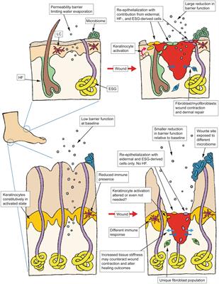 The case for considering volar skin in a “separate status” for wound healing